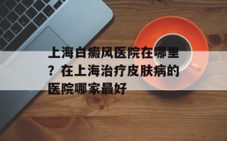 上海白癜风医院在哪里？在上海治疗皮肤病的医院哪家最好