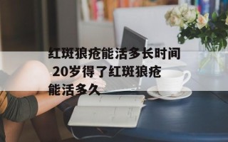 红斑狼疮能活多长时间 20岁得了红斑狼疮能活多久