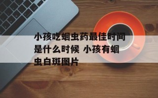 小孩吃蛔虫药最佳时间是什么时候 小孩有蛔虫白斑图片